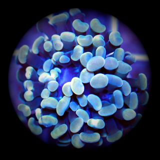 Euphyllia paraancora gold